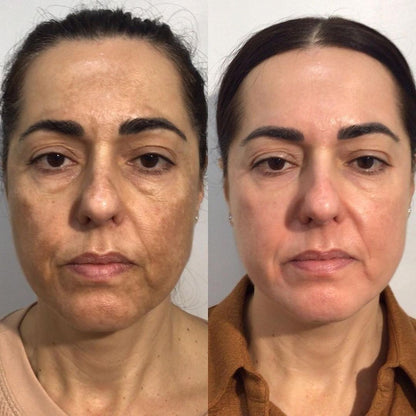 "RETINOL + CAFEÍNA =    ELIMINA AÑOS EN TU MIRADA"